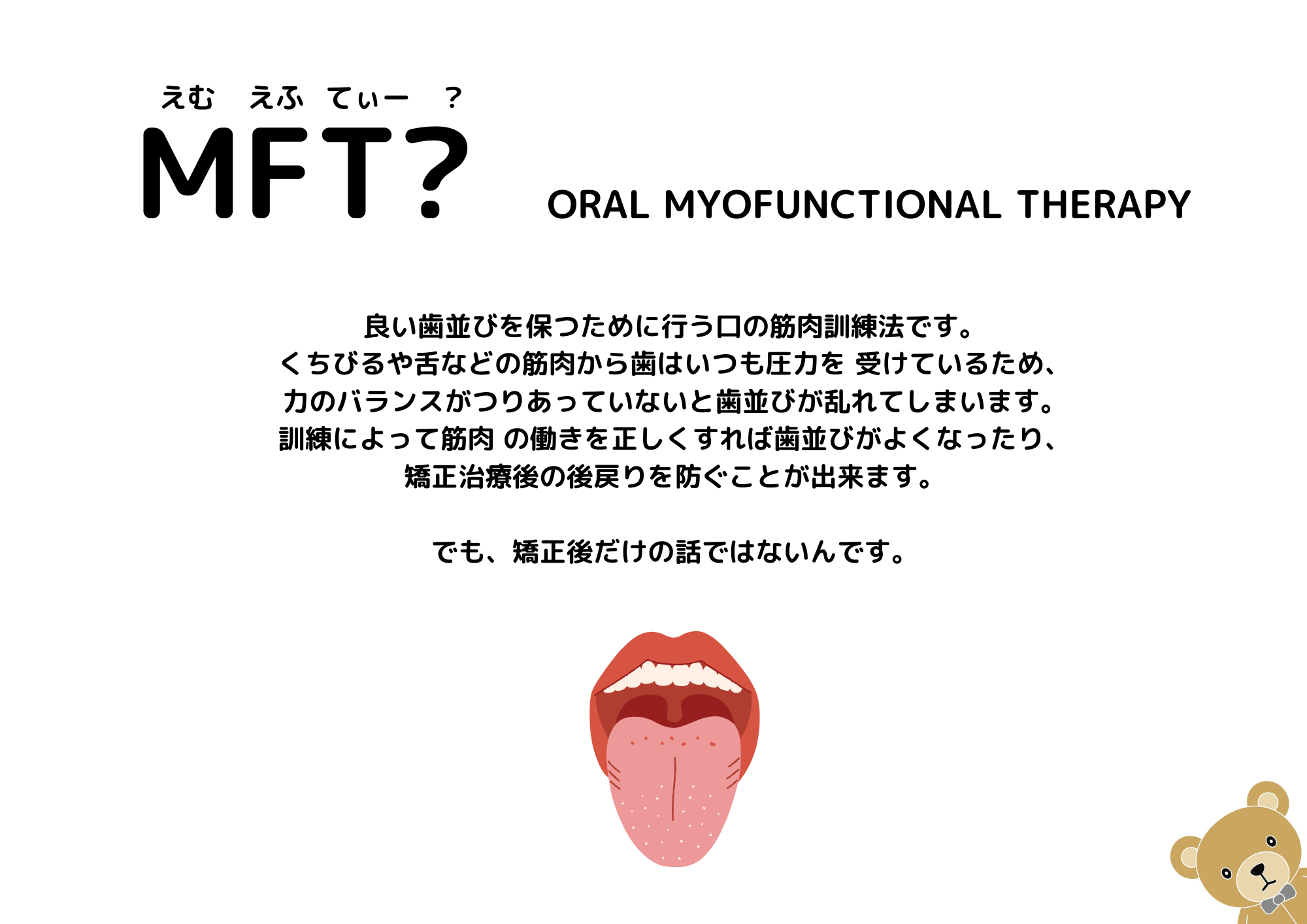 MFTのイメージ画像